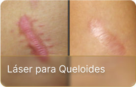 dm-laser (2)