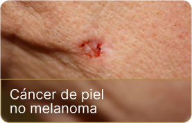 dm-oncologica (2)
