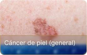 dm-oncologica (3)